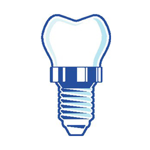 Dental Implant
