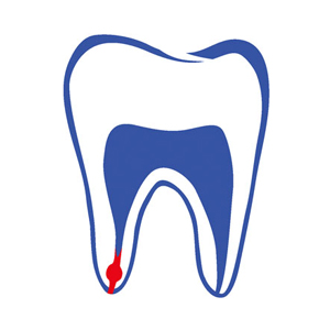 Root canal therapy